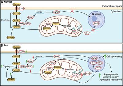 Acquired disorders of mitochondrial metabolism and dynamics in pulmonary arterial hypertension